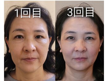 楓整骨院/続けるほど、美しく