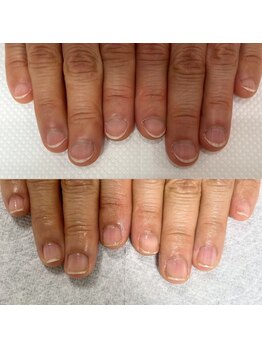 ウェルズユキ(well's yuki)/深爪/噛爪/コンプレックスな爪