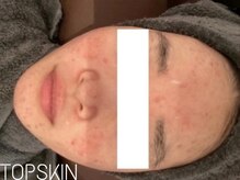 トップスキン 表参道(TOPSKIN)/どんなお肌悩みも内側から改善◎