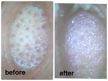 デューン 蕨店(Dune)/オプション◆毛穴洗浄