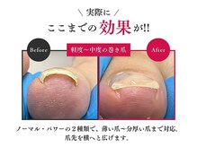 ネイルラボ 阿佐ヶ谷院(naillab.)の雰囲気（落ち着いた空間で施術◎巻爪,陥入爪,深爪,割れ爪なら当店へ!）