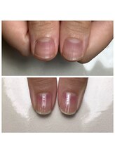 リヒネイル(Rihi.nail)/自爪育成