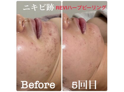 メロー(MELLOW)の写真