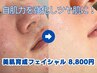何をしても改善しないニキビ、肌荒れにお悩みの方！【美肌育成フェイシャル】