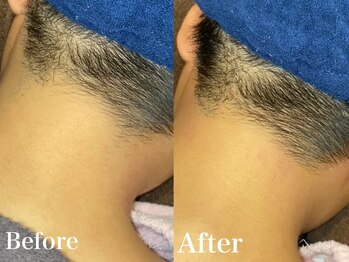 ジョエルワックス 沖縄那覇店(JOELLE WAX)/うなじWAX★デザイン可能★