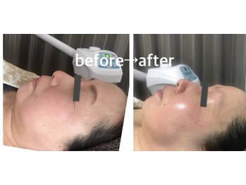 ハーティー(hati)の写真/お肌を綺麗にしてエイジングケア！艶、張り、潤い、透明感で小顔ケアを叶える感動エステ！