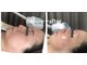 ハーティー(hati)の写真/お肌を綺麗にしてエイジングケア！艶、張り、潤い、透明感で小顔ケアを叶える感動エステ！