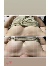 ファミリーセルフサロン 輪(Wa)/リンパマッサージ付きバストケア