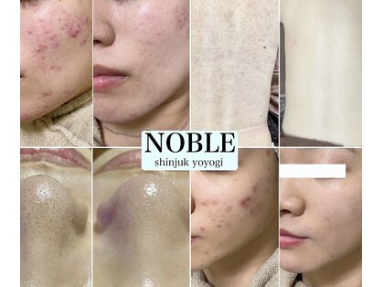 ノーブル 新宿南口(NOBLE)の写真