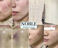 ノーブル 新宿代々木店(NOBLE)