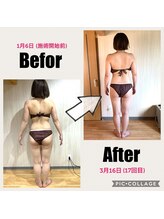 アンベリール(Embellir)/Before・After