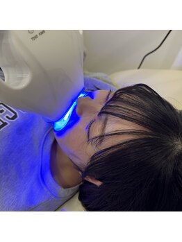 ホワイトニングショップ 奈良香芝店(Whitening shop)/ホワイトニングの照射光は青い光