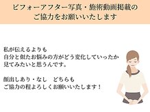 ペルク(perk)/ご協力お願いいたします