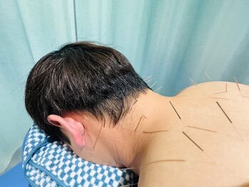 赤沼鍼灸整骨院/鍼で首肩こり、腰痛を根本改善！
