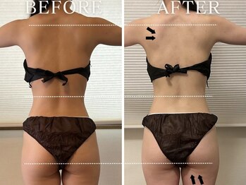 ヨサパーク リバティ 三田(YOSA PARK Liberty)/短期間で結果重視最速ダイエット