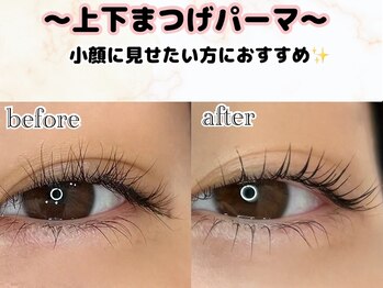 ルルバイアズール 草加店(LULU by azule)/小顔効果!!