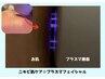 【ニキビ肌ケア専用！】プラズマ機器でニキビ菌へアプローチ◎ ずっと3000円!