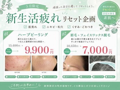 ムーンサン(Moon sun)の写真