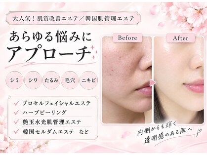 リベルテ(Liberte)の写真
