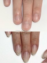 マリーロール 梅田店(Marie Laure)/自爪育成/深爪矯正/ネイルケア