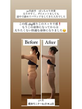 フローラ 自由が丘(Flora)/インナーケア