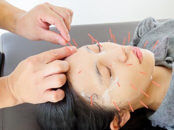 Drハリー 新宿/幹細胞パック美容鍼