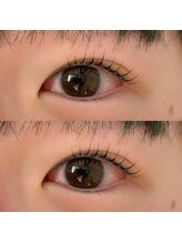 ハービンドール/【ラッシュリフト】