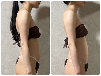 スリーピングビューティー(Sleeping Beauty)/インディバ　姿勢改善