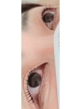 コア(Koa)/パリジェンヌアップリフト