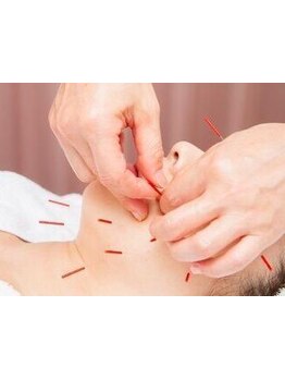 小顔になりたい