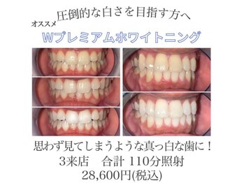 ライトビューティー 池袋店(LightBeauty)/症例写真