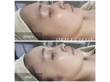 メイリー(MEILI)/