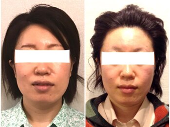 美容整体 ウェリナ 蟹江院/小顔矯正/骨盤矯正/美脚サロン