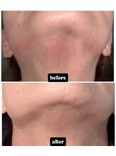 銀座エイジングケアサロン/ビフォーアフター♪