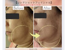 マールム(MALUM)/「レッドショット」