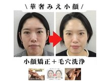 ブプラ 秋田山王店(BUPURA)