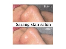 サラン スキンサロン(Sarang skin salon)の雰囲気（黒ずみ角栓をケアし毛穴レスなツヤ肌へ）
