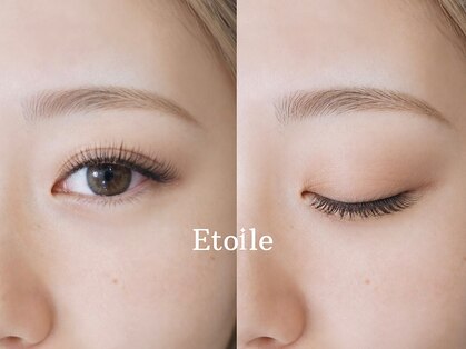 エトワール(Etoile)の写真