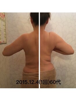 アーニストリィ(Earnestly)/◆３Dボディ+リンパマッサージ◆