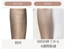 ファーレイン 長崎市の雰囲気（ムダ毛が気にならなくなり短いスカートも自信を持って履ける！）