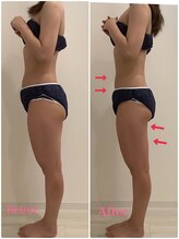 スペチアーレ 夙川/高額マシンで脂肪をトイレに流す