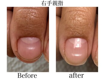 トイロ ネイル(Toiro Nail)/◇HAND◇クイックケア