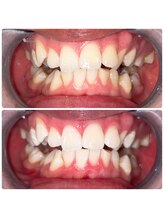 コナホワイトニング 神保町/ホワイトニング