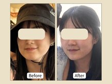 ミリュー(mylieu)/他撮りも怖くない超立体小顔へ！