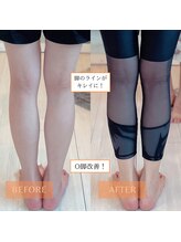 サンテリア(Santelia)/0脚改善1ヶ月