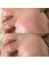 ルアラナ(Lualana)/アンストレス一度の変化