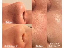 ビジュープラス 水戸店(Bijou+)の雰囲気（毛穴それぞれの状態に合わせて、適切なアプローチを行います♪）