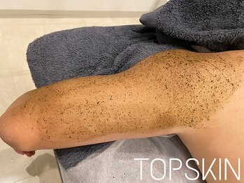 トップスキン 久屋大通(TOPSKIN)/メンズのボディケアも人気です☆