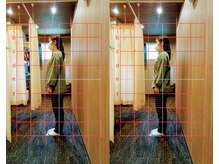 きぼう鍼灸整骨院/前重心がキレイになりました