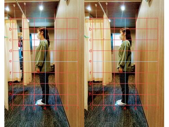 きぼう鍼灸整骨院/前重心がキレイになりました